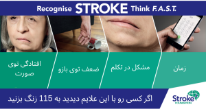 علائم سکته مغزی را بشناسید.