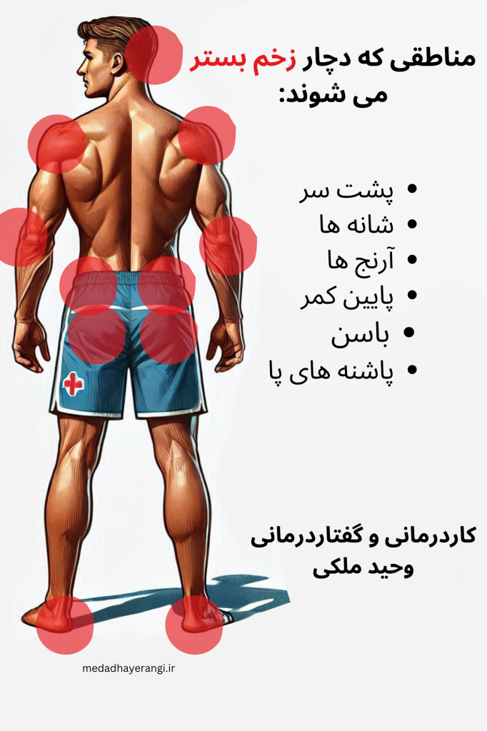 مناطقی که دچار زخم بستر میشوند کدام اند؟